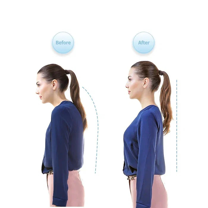 smart-posture-corrector-neck-hump-straight-41192351_4.jpg